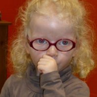 petite fille albinos